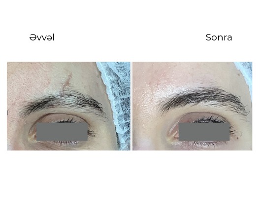 Candela Nordlys Mini